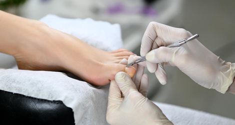 Chiropody Treatment